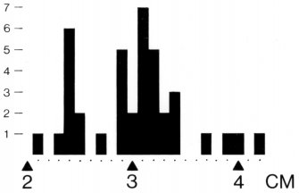 Bar-chart showing plank-joint thicknesses as indicated by the shank-length between the rivet-head and rove of the boat fastenings (see Perth15 and 19).