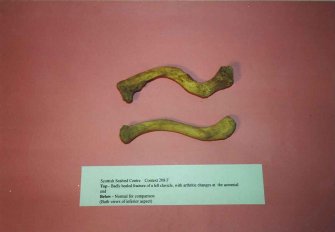 Human Remains, Sample Reference SK605, Scottish Seabird Centre, North Berwick