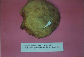 Human Remains, Sample Reference SSC00 030, Scottish Seabird Centre, North Berwick
