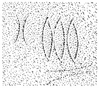 Scanned ink drawing of Pictish symbol (triple oval) and  pair of "inverted brackets" in Sculptor's Cave