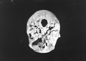 I11 46 Skull 10 basal view, no scale.