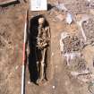Archaeological excavation, Skeleton 158: general with board etc., Auldhame, East Lothian