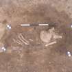 Archaeological excavation, Skeleton 195: badly plough-damaged skeleton, Auldhame, East Lothian