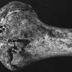 Post ex photograph : arthritis in bone from skeleton from grave III.