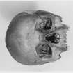 Isbister Orkney Burial Mond Skulls