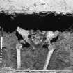 Excavation photograph - detail of skeleton 1 pelvis exposed in trench 2, from E